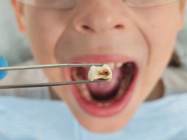 Best Emergency Denture Repair in Friendship Heights Village, MD